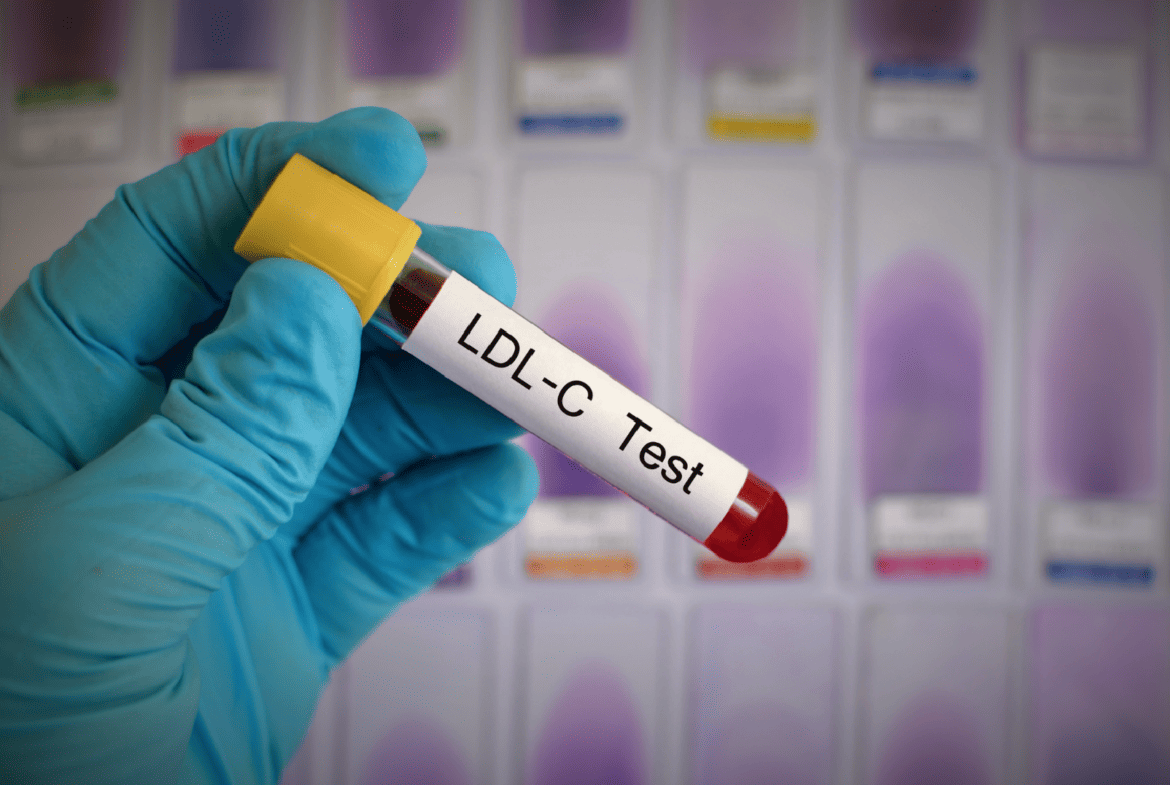 研究發現跨性別男性的HRT可能升高LDL降低HDL，但仍無證據顯示會增加致病風險。