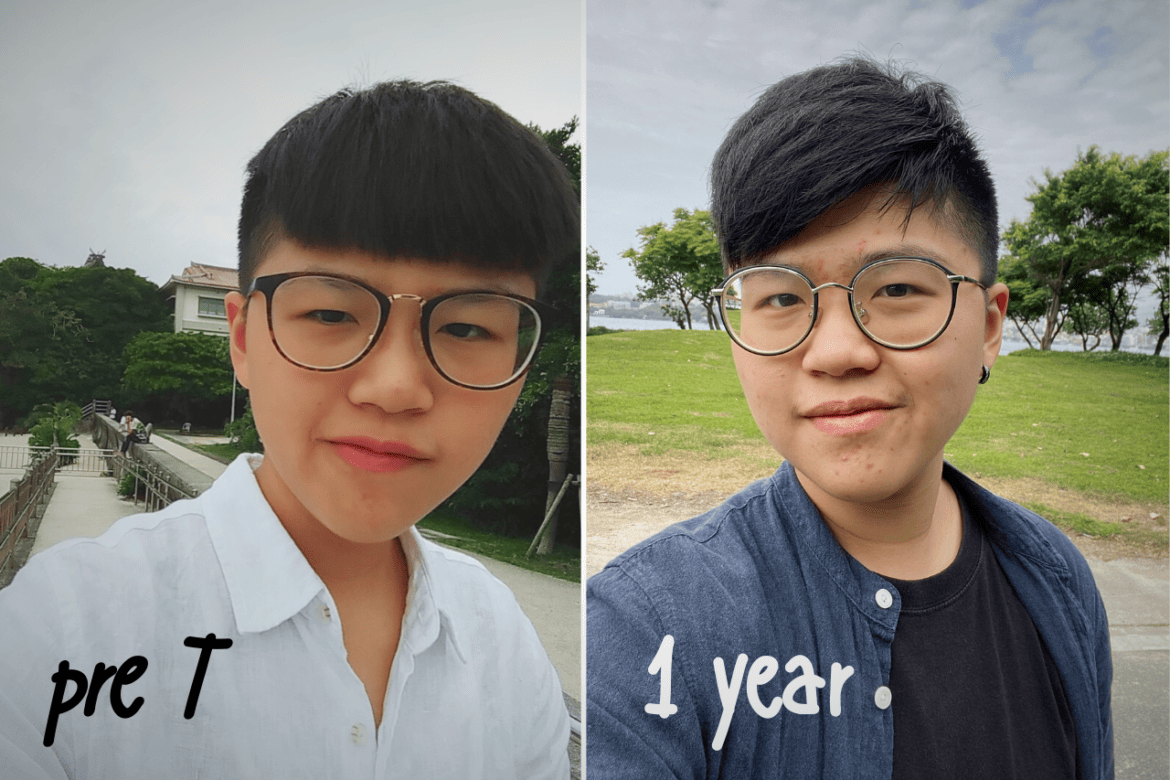 終於HRT一周年啦~一年的時間完全可以用飛快來形容，感覺才剛學會打針而已，沒想到已經默默變成小時候夢想中的那個男人了。